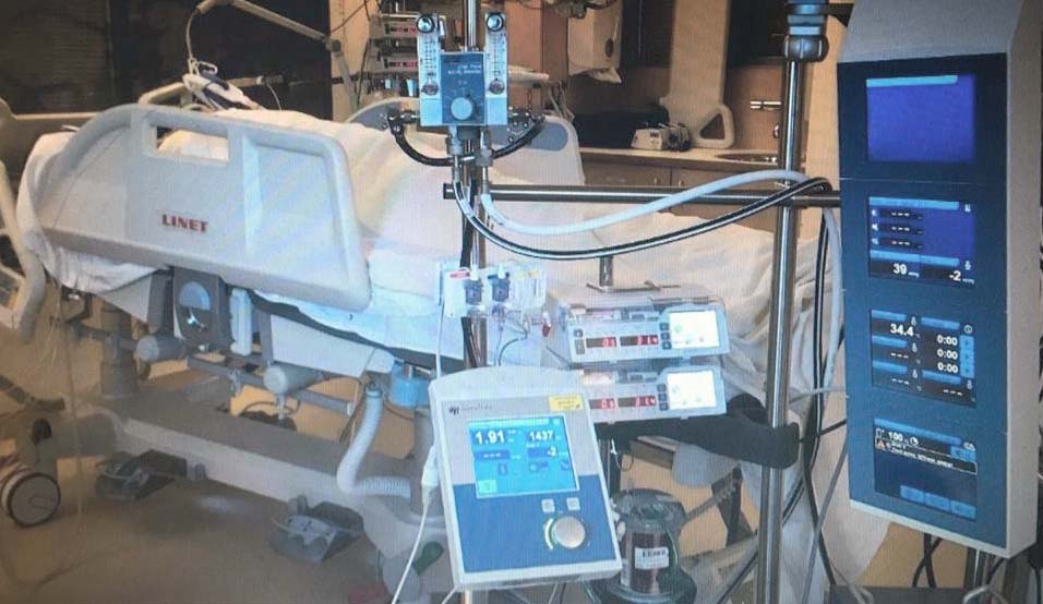 A técnica utilizada, chamada de respiração extracorpórea, está sendo disponibilizada em algumas dezenas de hospitais no país, a exemplo do Hospital Albert Einstein, de São Paulo. Foto: divulgação