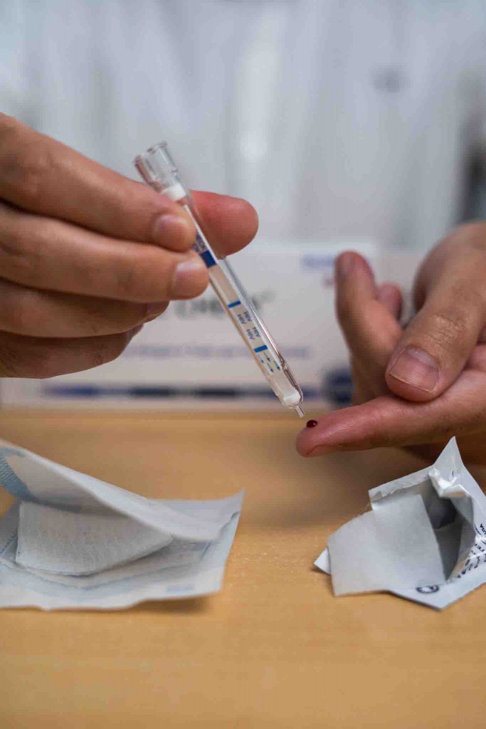 Produzido pela Chembio Diagnostics Brazil, o produto revoluciona o diagnóstico da infecção, que será realizado de forma simples em apenas 15 minutos