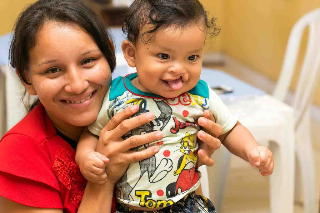 Celebrando o seu 40º aniversário, organização reforça seu compromisso de contribuir para a transformação dos sistemas de saúde, atendendo às necessidades mais críticas no tratamento das fissuras. Foto: cartilha Operação Sorriso Brasil.