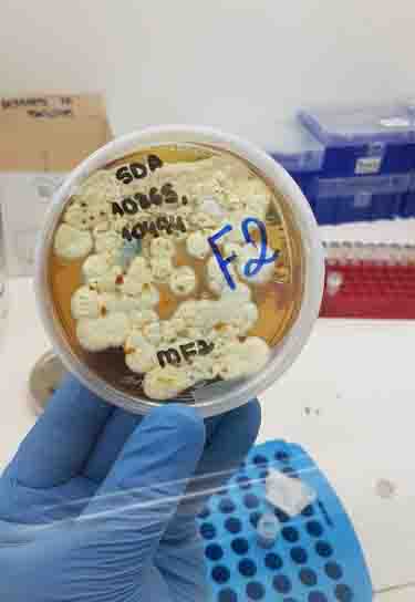 TransplanteBiologico_Andre May_1