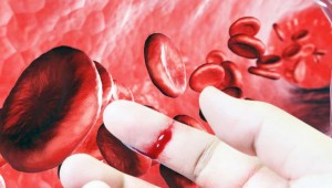 Dia 17 de abril celebra-se o Dia Mundial da Hemofilia: uma anomalia que dificulta a coagulação do sangue. Foto reprodução.