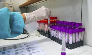 A iniciativa é da RedeVírus, do Ministério da Ciência, Tecnologia e Inovações. Participam da pesquisa mil profissionais da saúde. Foto: Acássio Pinheiro / Agência Brasil.