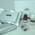 O novo kit é prático e permite testagem de várias amostras em curto espaço de tempo, além de automação na obtenção dos resultados. Foto: Eliana Cezar / Divulgação