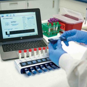 O teste utiliza o método IGRA, considerado padrão ouro e recomendado pela Organização Mundial da Saúde. (divulgação)