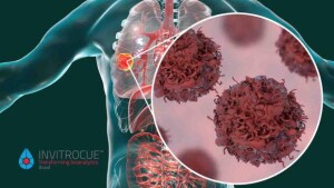 Descoberta pode ajudar no desenvolvimento de terapias futuras para impedir que as células cancerígenas cresçam e sobrevivam. Imagem freepik / divulgação