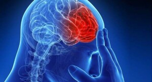 Maior estudo do mundo que apontou diminuição de 49% na reincidência de AVC com o uso de anticoagulante em pacientes com fibrilação atrial subclínica foi destaque na 16ª edição do International Symposium of Thrombosis and Anticoagulation (ISTA). (Divulgação)
