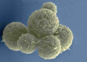 Colônia formada pelas células mínimas desenvolvidas na pesquisa. Crédito: Nacyra Assad Garcia/JCVI