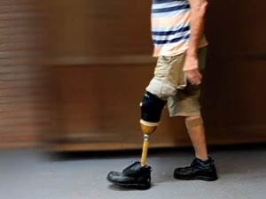 Edital de pesquisa faz parte de iniciativa com USP e Unicamp apoiada por governo de SP. Prótese de bambu desenvolvida em pesquisa da Unesp em Bauru.  Crédito: João Victor Gomes dos Santos.