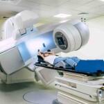 2, quando não está mais restrito ao órgão. A doença, causada por infecção pelo papilomavírus humano (HPV) deve acometer mais de 17 mil brasileiras em 2025. (Saragolfart /Depositphotos)
