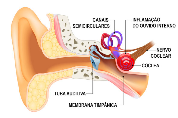 Especialista alerta que esse sintoma pode indicar desde acúmulo de cera até condições mais graves. (Imagem: pesquisa Google)