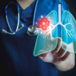 Ferramenta leve, que roda em computadores hospitalares comuns, usa mapas de calor para indicar onde a rede neural “prestou atenção” e pode apoiar diagnósticos mais rápidos e confiáveis. (Divulgação)