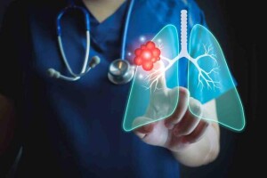 Ferramenta leve, que roda em computadores hospitalares comuns, usa mapas de calor para indicar onde a rede neural “prestou atenção” e pode apoiar diagnósticos mais rápidos e confiáveis. (Divulgação)