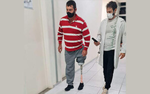 Projeto da Faculdade de Ciências de Bauru usa liga metálica inoxidável leve e resistente à corrosão, e possui dimensões similares às de um joelho natural. (Divulgação / Lab. de Anelasticidade e Biomateriais).