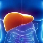 Inflamação e fibrose do fígado levam à MASLD; atividade física e boa alimentação são opções para evitar o problema. (Reprodução BVS – Ministério da Saúde)