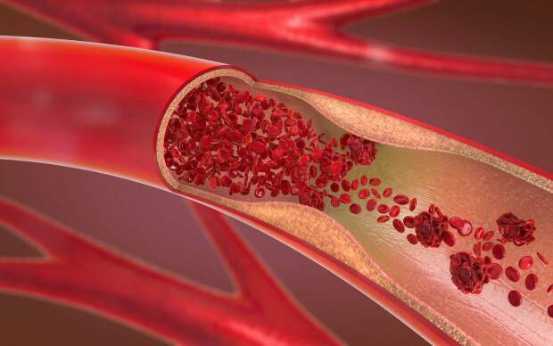 (Corrente Sanguinea / Crédito: Christoph Burgstedt/Shutterstock)