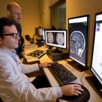 Tecnologia auxilia médicos na identificação de alterações cerebrais e oferece mais precisão na investigação de doenças neurodegenerativas. (Divulgação)
