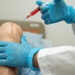 Nova norma passa a autorizar o procedimento médico auxiliar ao tratamento de quatro condições osteomusculares: osteoartrite de joelho, discopatia lombar, epicondilite lateral do cotovelo e reparo meniscal. (Foto: pesquisa Google / Reprodução)
