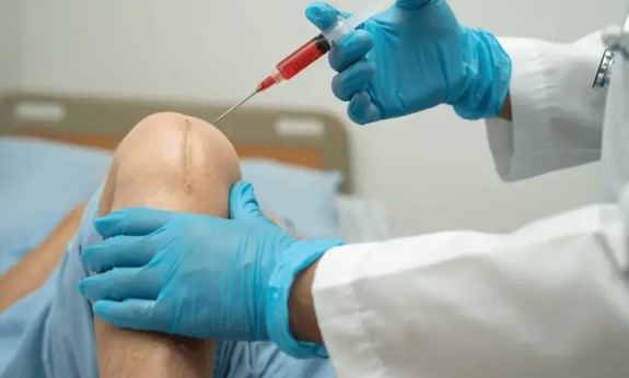 Nova norma passa a autorizar o procedimento médico auxiliar ao tratamento de quatro condições osteomusculares: osteoartrite de joelho, discopatia lombar, epicondilite lateral do cotovelo e reparo meniscal. (Foto: pesquisa Google / Reprodução)