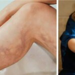 Encontro internacional promovido pela Sociedade Brasileira de Trombose e Hemostasia – SBTH discute avanços no diagnóstico, prevenção e tratamento de doenças trombóticas e hemorrágicas. (créditos: Alina Rossoshanska / Patty Brito)